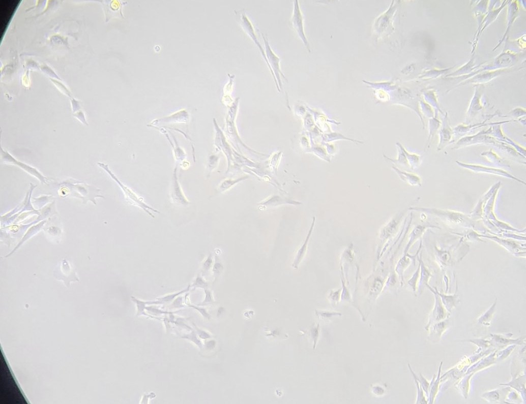 Phase contrast micrograph down the eyepiece: spindle-shaped adherent cells spread across the field at moderate confluence.