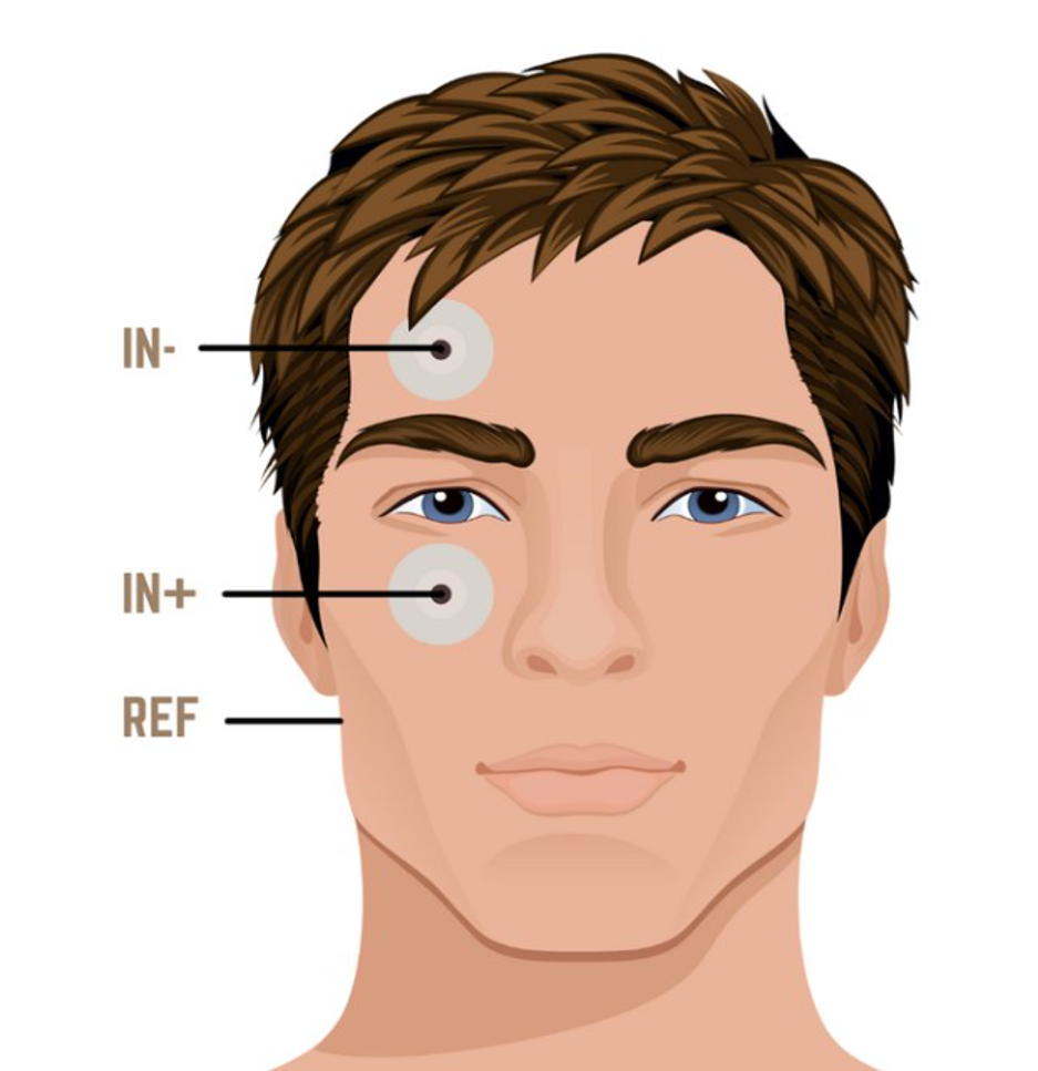 Diagram of electrode placement on a face: the inverting input above the eyebrow, the non-inverting input beside the outer eye, and the reference on the jaw.