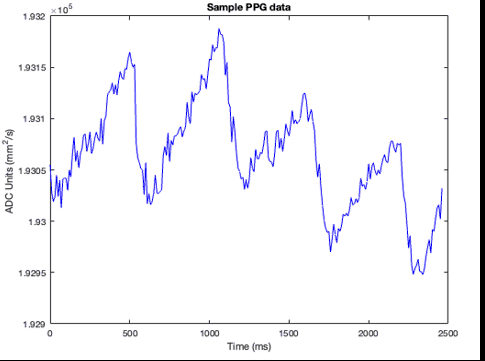 A sample trace recorded from the wearable: amplitude in ADC units against time in milliseconds, showing four slow rising ramps with sharp falls over two and a half seconds.