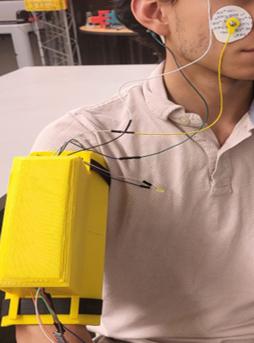 The wearable in use: electrodes taped above and beside one eye, their leads running down to a printed yellow enclosure clipped at the shoulder.